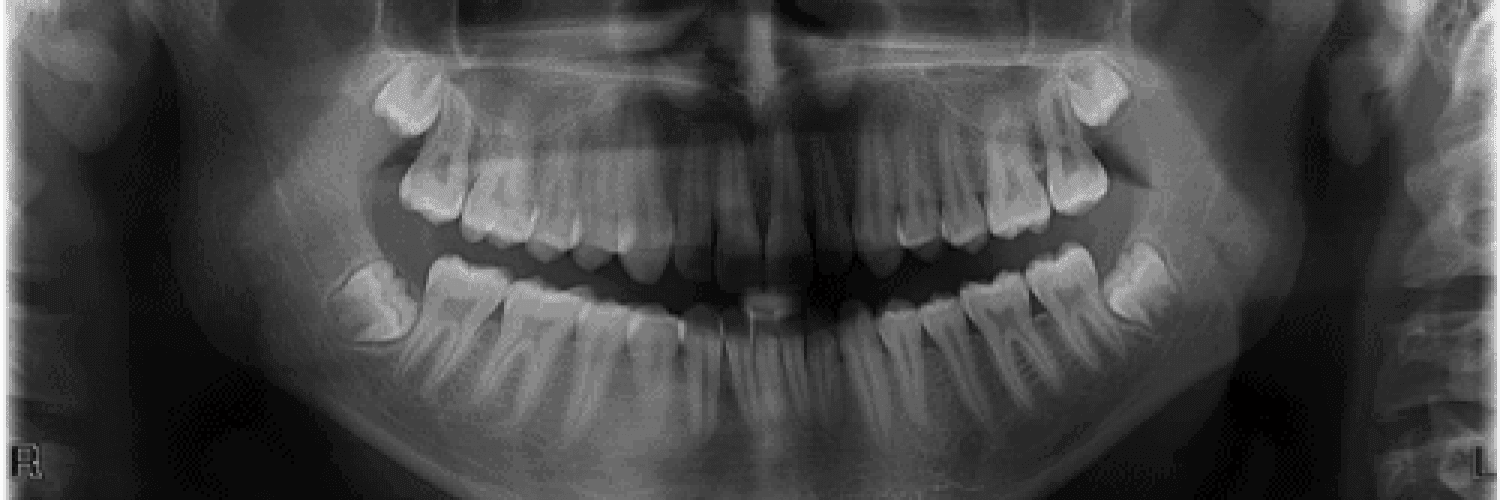 Dental online Radiography